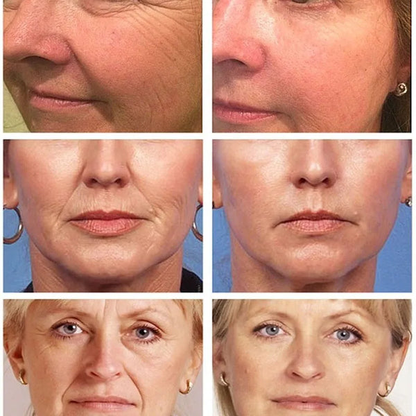 Mask Reduce Fine Lines